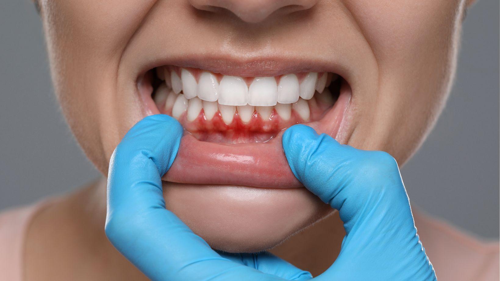 implant dentistry gum disease, dental implants after gum disease, gum disease patient implants, safe implant strategies gum issues, predictable implant outcomes gum disease, gum disease dental implant treatment, implant solutions for gum disease, gum disease and implant success, preventive implant dentistry gum health, gum disease supportive implant care